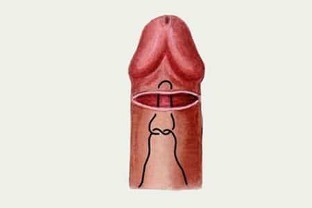 როგორ უნდა გაიზარდოს penis